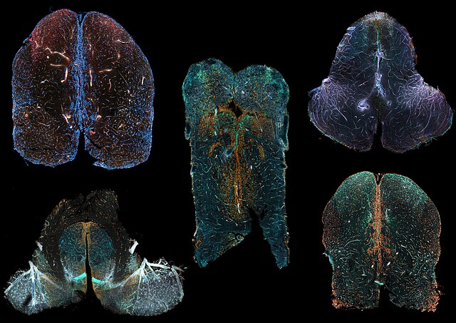 Thomas Willis, Swedenborg, and Embodied Consciousness